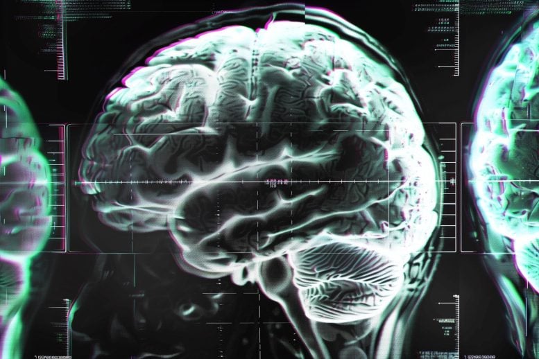 Brain-Disorder-Glitch-Concept-777×518-1